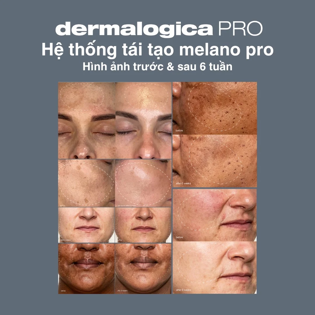 cai-tien-phuong-thuc-tiep-can-da-nam-thong-minh-tu-dermalogica-20241025-dnplus-4.jpg